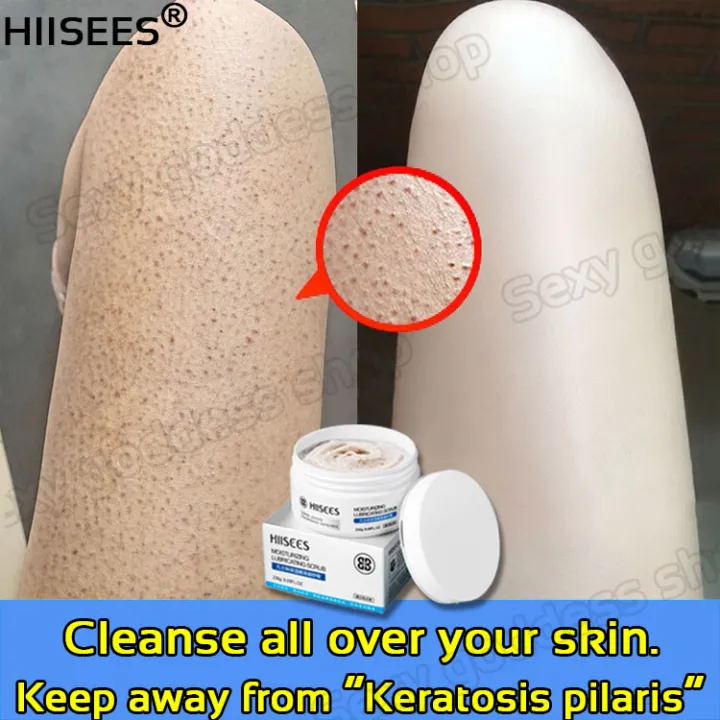 HIISEES Scrub Cream 230g,gently exfoliate,deeply moisturize, improve