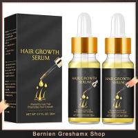 Biotin Thickening Herbal Serum Fast Hair Growth Essence Oil Ginger Hair Growth Serum Hair Loss Essence Oil