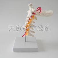 Cervical spine vertebra occipital cervical disc model with carotid artery model model