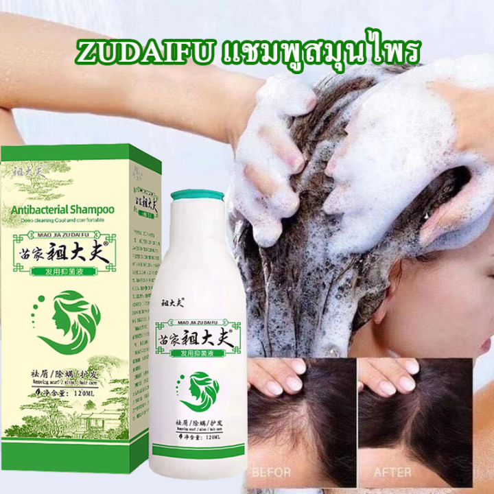 แชมพูสมุนไพร-zudaifu-hair-shampoo-ยาสระผมและครีมนวด-ยาสระผมขจัดรังแค-ยาสระผมลดผมร่วง-เชื้อราบนศีรษะ-บำรุงเส้นผมและหนังศรีษะ