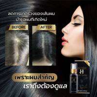 บาลานซ์ เอช สเปรย์  ?ของแท้ ส่งฟรี? Balance H  BLH Hair Tonic Spray  บำรุงเส้นผม ปลูกผม ปลูกคิ้ว ปลูกหนวดเครา ผมร่วง ผมบาง (1ขวด100ml.)