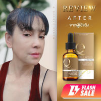 [ ขายดีอันดับ 1 ] ⚡️ Flash sale ⚡️ Q Double Serum เซรั่มคิว Q serum คิวดับเบิ้ลเซรั่ม ในตำนาน ดังใน tiktok กดติดตามร้านค้า ลดเพิ่ม 10.-บาท