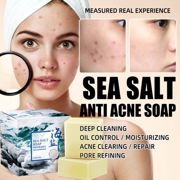 Sea Salt Soap Removal Pimple Pores Acne Treatment Cleaner Moisturizing