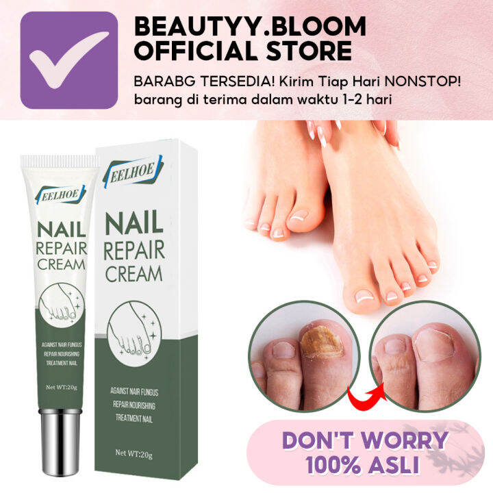 Eelhoe Nail Repair Cream 20g Krim Menghilangkan Jamur Kuku