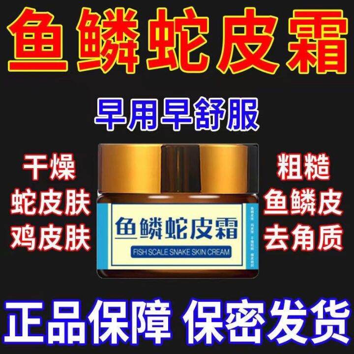 [Fish Scale Snake Skin Cream] Remove Chicken Skin Fish Cream Dry Scales Peeling On Legs tool