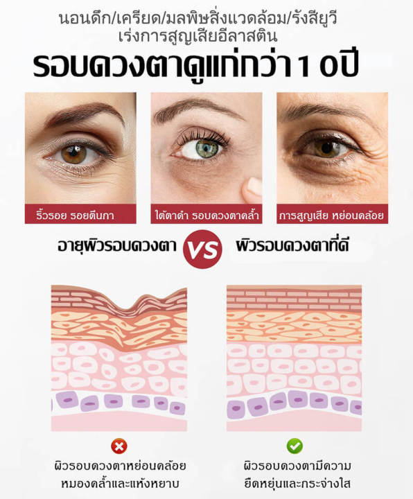 ครีมลดถุงใต้ตา-ครีมทาถุงใต้ตา-ครีมลบถุงใต้ตา-ครีมทาใต้ตาดำ-retinol-eye-cream-อายครีมเรตินอล-กระชับ-ยกกระชับ-อายครีมลดริ้วรอย-ลดบวมถุงใต้ตา-ขอบตาดำ-และอนุภาคไขมัน