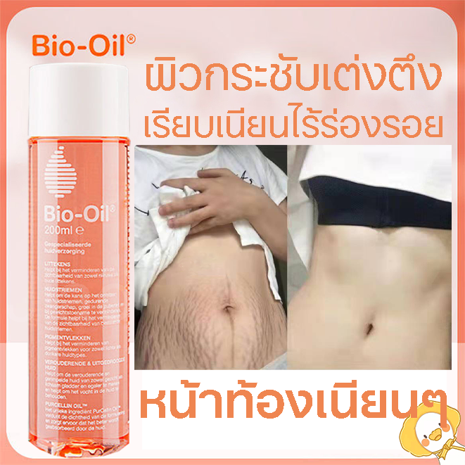 Bio Oil ไบโอ ออยล์ [200 Ml.] ฟื้นฟูผิว รอยแตกลาย ขนาด บำรุงผิว  แตกลายและรอยแผลเป็น ลดเลือนรอยแผลเป็น ผิวแตกลาย ให้ดูจางลง ครีมลดรอยแตกลาย  ครีมแก้ท้องลาย ลดการแตกลาย | Lazada.Co.Th