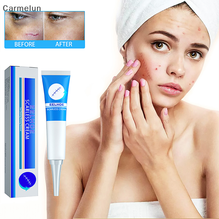 [Carmelun] 20g Scar Removing Gel Scars Removal Creams For Skin Barrier Repair Scar Removal Cream