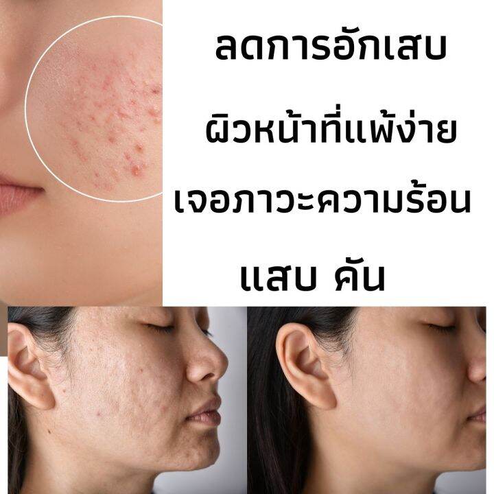 กิฟฟารีน-รีแพรี่-ทรีทเมนท์-เพื่อผิวพิเศษ-ของแท้-100-ผิวให้แข็งแรงด้วย-betaglucan-ที่ปกป้องและฟื้นฟูผิวจากการเผชิญแสงแดดและมลภาวะ