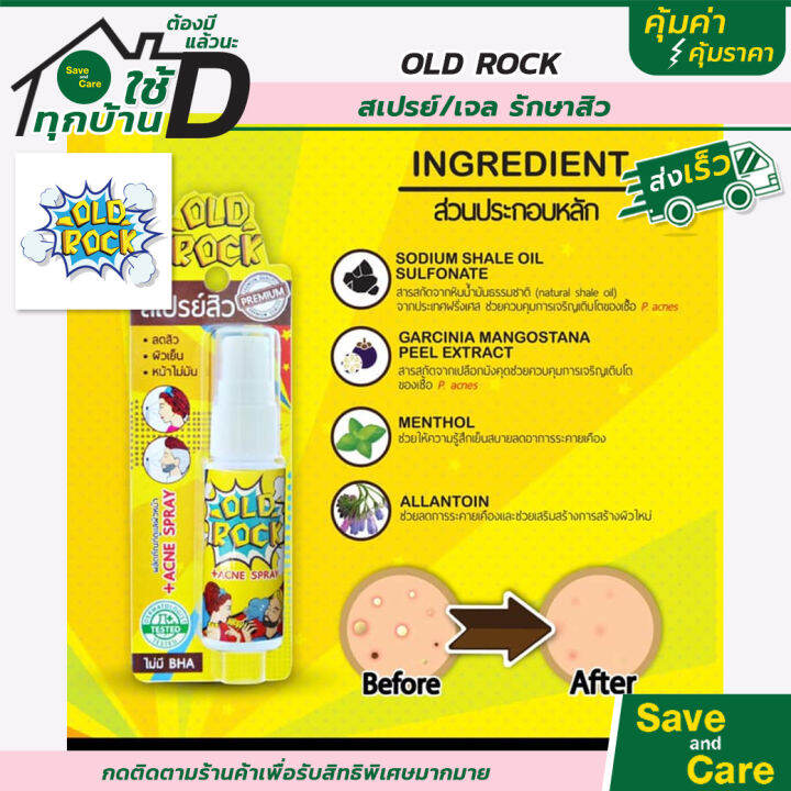 oldrock-สเปรย์ลดสิว-เจลลดสิว-ลดมัน-เย็นสบายหน้า-ขนาด-15-มล-saveandcare-คุ้มค่าคุ้มราคา