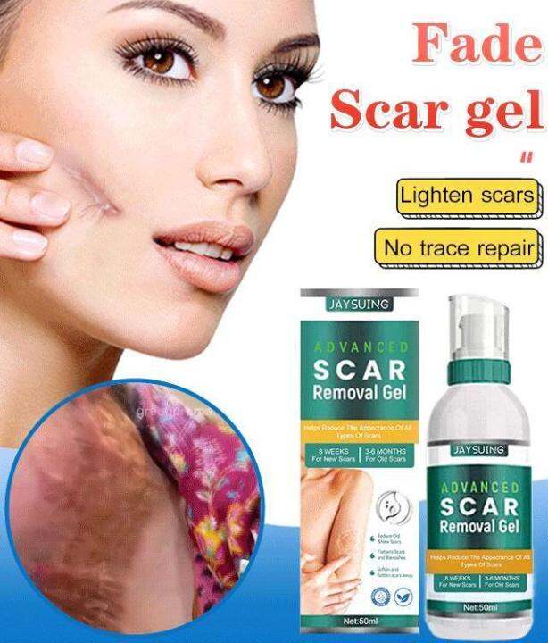 guibai Jaysuing Scar Fading Gel for Scar Softening and Skin Smoothing ...