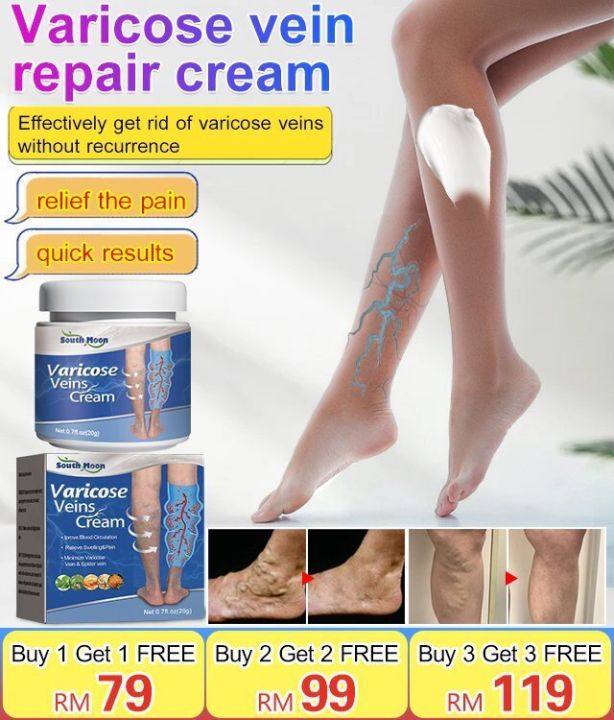 Gorich 1 2PCSSouth Moon Varicose Vein Repair Cream Pain Swelling Cream 20g Lazada PH