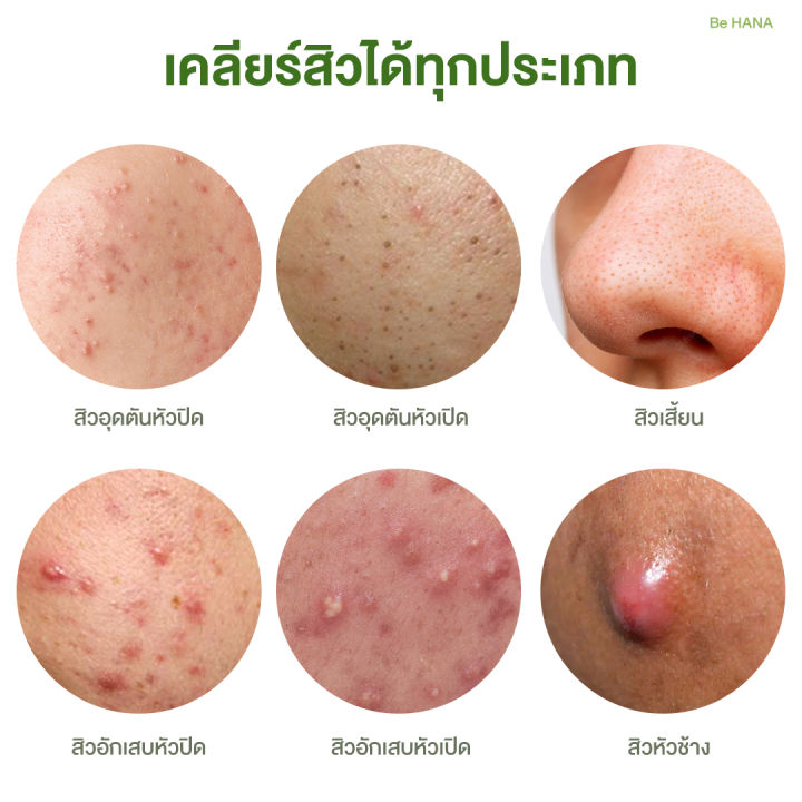 be-hana-บีฮาน่า-เซรั่มไฮยาใบบัวบก-ลดสิว-ลดรอยสิว-คุมมัน-ผิวชุ่มชื้น