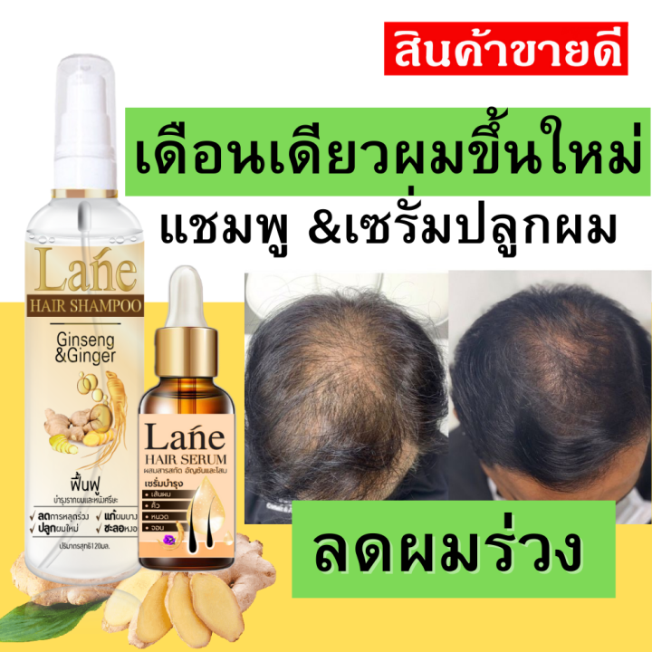 Lane แชมพูลดผมร่วง เซรั่มปลูกผม บำรุงรากผม ชุดปลูกผมดกดำ เดือนเดียวผมขึ้นใหม่ ลดผมหงอก Lazada