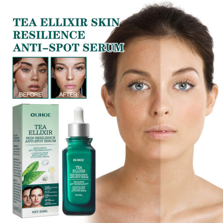 Whitening Freckle Facial Serum Dark Spot Corrector Powerful Removing