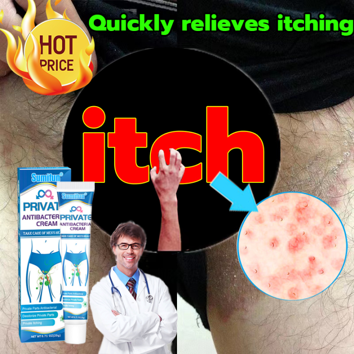 SUMIFUN ointment for itchy skin and allergy Private itching cream For