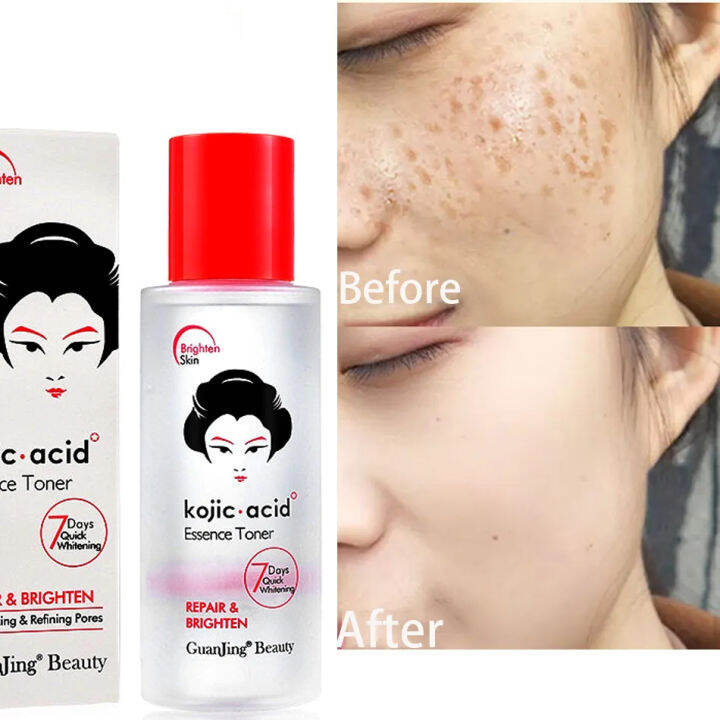 Kojic Acid Face Toner Repair and Brighten Essence Anti Wrinkle Skin ...