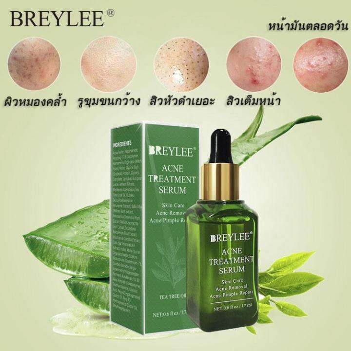 breylee-เซรั่มรักษาสิว-17ml-ครีมแต้มสิว-เจลแต้มสิว-เหมาะสำหรับผิวมันและสิว-สามารถลดสิว-บล็อกสิว-สิวไม่อักเสบ-สิวหัวขาว-สิวหัวดำ-และกระชับรูขุมขน-บอกลารูขุมขนกว้างได้ง่ายๆ-หลุมสิว-ซ่อมแซมรอยสิว-รอยสิว-