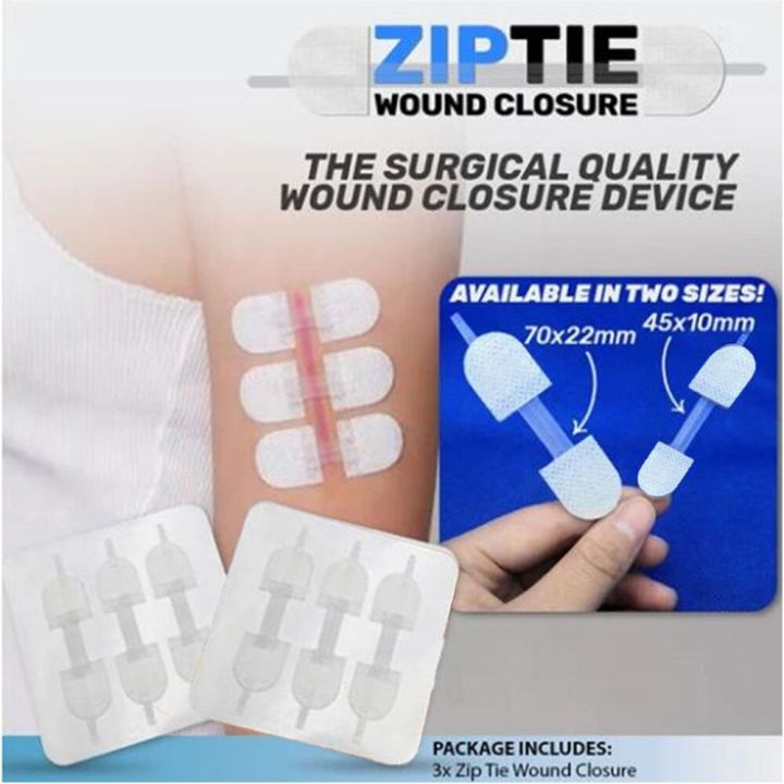 3pcs-disposable-zip-tie-wound-closure-patch-hemostatic-adhesive-aid-emergency-kit-laceration-band-aid-without-stitches