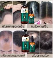 นีโอแฮร์ของแท้100% แชมพู&amp;เซรั่มแชมพูขิง,แชมพูแก้ผมร่วงแชมพูขิงเพียวแชมพูขิงชุดรวมแชมพูขิงบำรุงหนังศรีษะแชมพูปลูกผมสระผมแก้ร่วงยาสระว