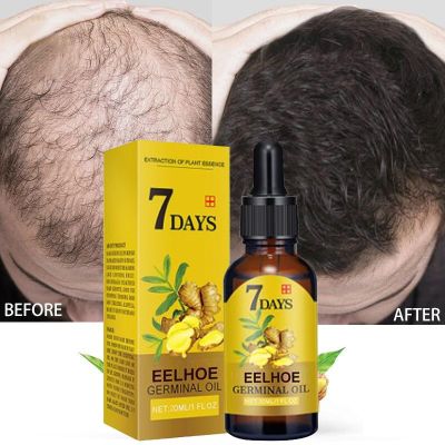 【cw】 Hair Growth Products Ginger Fast Growing Hair Essential Oil Beauty Hair Care Prevent Hair Loss Oil Scalp Treatment For Men Women ！