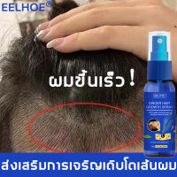 สเปรย์ปลูกผม EELHOE 30g ปรับปรุงคุณภาพของเส้นผม ป้องกันผมร่วง เร่งผมขึ้นใหม่ แก้ปัญหาหัวล้าน เร่งผมงอกใ ยาปลูกผม เร่งผมยาว ยาปลูกผมของแท้ เซรั่มปลูกผม น้ำยาปลูกผมชาย ปลูกผมเร่งด่วน น้ำยาปลูกผมดก