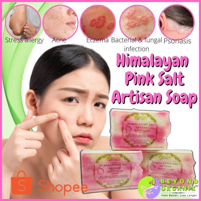 Pure Pink Himalayan Artisan Soap (AntiAcne & Pimple Breakout Natural