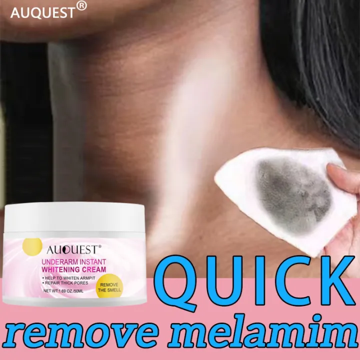 【quick Whitening Of Underarms】auquest Underarm Whitening Cream Body Dark Skin Underarm Legs 4721