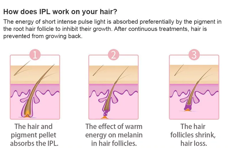 DEESS IPL Laser Hair Removal Device for Women Upgraded Unlimited Flashes Fastest Automatic Flash IPL Hair Removal Device for Women Home Us | DEESS IPL Laser Hair Removal Device for Women Upgraded Unlimited Flashes Fastest Automatic Flash IPL Hair Removal Device for Women Home Us |