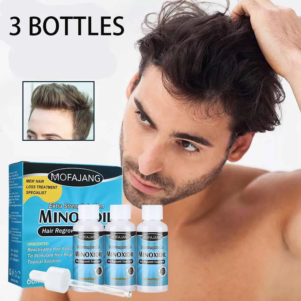 Top 4 thuốc kích thích mọc tóc tốt nhất cho nam giới 2023