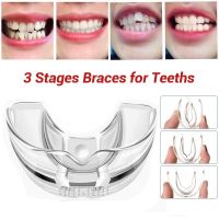 3ขั้นตอนทันตกรรมจัดฟันอุปกรณ์จัดฟันจัดตำแหน่งเทรนเนอร์ฟันยึด Bruxism ปากยามฟันที่หนีบผมตรง