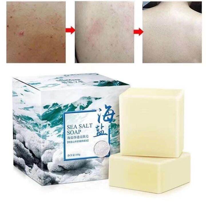 Natural 100g Sea Salt Soap Removal Pimple Pores Acne Treatment Cleaner
