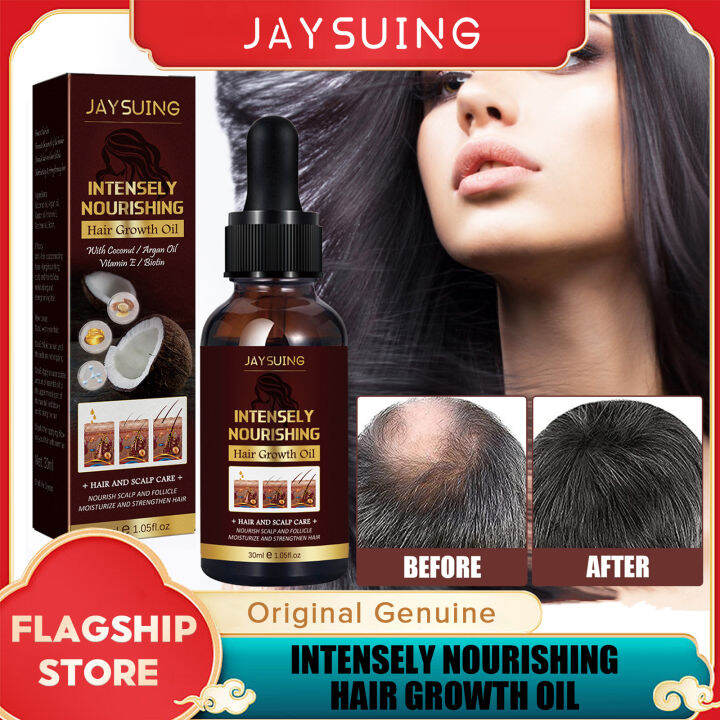 Jaysuing Intensely Nourishing Coconut Hair Growth Oil Natural Anti Hair ...