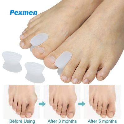 ✁﹍♀ Pexmen 2/4Pcs Gel Toe Separators Bunion Pads Toe Spacer for Overlapping Crooked Toes Calluses Bunions for Men and Women