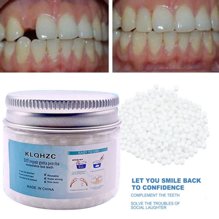DIY Temporary Tooth Repair Kit Set Teeth and Gaps Resin False Teeth
