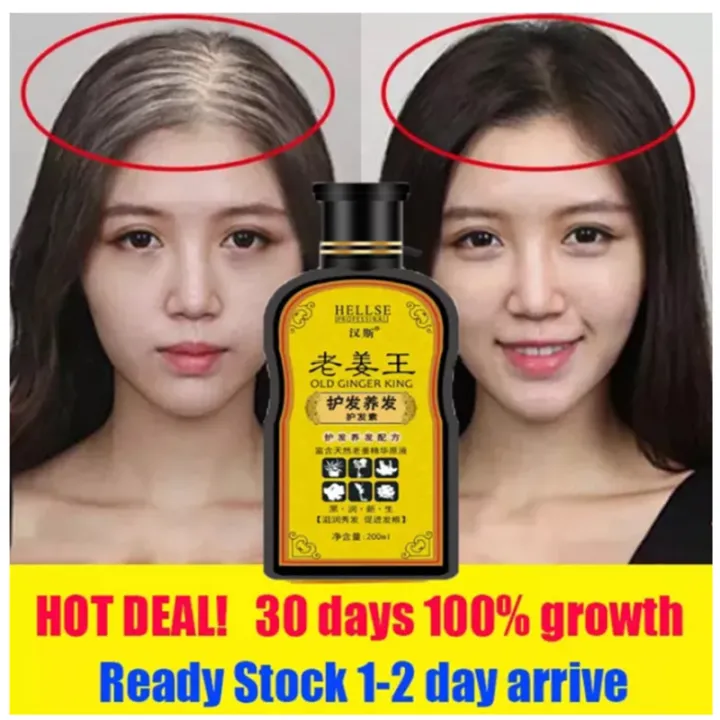 Ginger shampoo hair loss Ginger hair growth shampoo Original Ginger