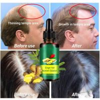 【cw】 Hair Growth for Men Lacquers Plant Essential Oil Care Styling Loss Thick Fast Repair Growing Treatment Products