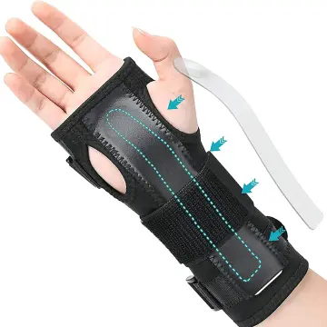 Velpeau Wrist Brace Thumb Spica Splint Support for De Quervain's  Tenosynovitis, Carpal Tunnel Syndrome, Stabilizer for Arthritis,  Tendonitis, Sprains
