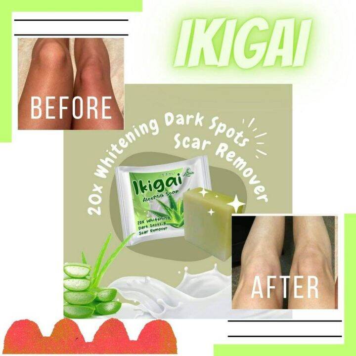 IKIGAI Aloemilk Soap 70g Whitens skin,Anti Pimple and Acne,Removes skin