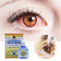 Thuốc Nhỏ Mắt Mát Lạnh Y Tế 15ML Làm Giảm Mắt Đỏ Làm Sạch Giải Độc Mắt Khử Trùng Mắt Mờ Mắt Khô Ngứa Bảo Vệ Sức Khỏe Thị Lực