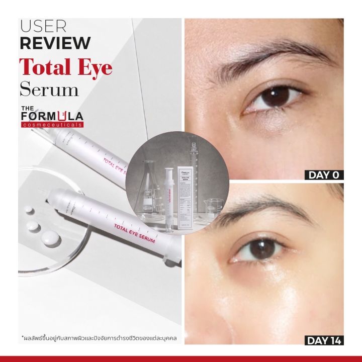 สินค้าขายดีมาก-the-formula-total-eye-serum-10-ml-ครีมทารอบดวงตา-ครีมทาใต้ตา-ลดตาคล้ำถุงใต้ตาและริ้วรอยรอบดวงตา