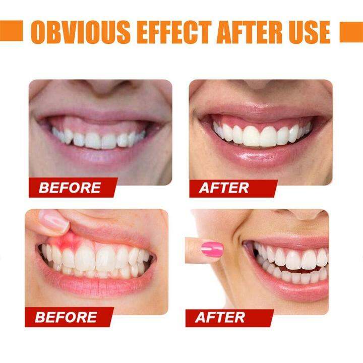 teeth-cleansing-toothpaste-tooth-whitening-enamel-care-remover-refreshing-oral-dental-care-oral-hygiene-v34-colour-corrector