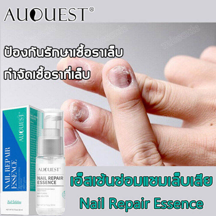 auquest-เชื้อราเล็บมือ-ยาทาแก้เชื้อราที่เล็บ-บำรุงเล็บ-น้ำยารักษาเล็บ-รักษาเล็บเสีย-น้ำยาล้างเล็บ-เซรั่มบำรุงเล็บ-เซรั่มรักษาเล็บ-รักษาเล็บ-ยารักษาเชื้อราที่เล็บ-น้ำมันบำรุงเล็บ-เอ็สเซ้น-ซ่อมแซมเล็บเส