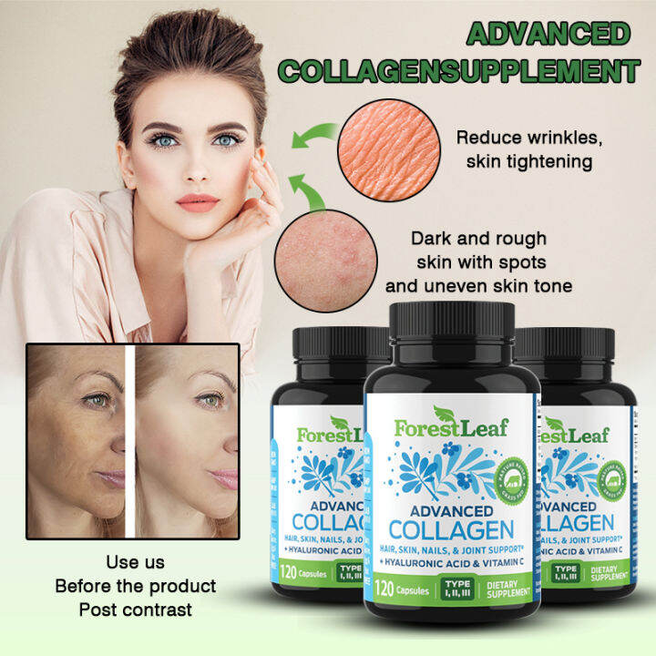 ForestLeaf - Collagen Capsules with Hyaluronic Acid & Vitamin C ...