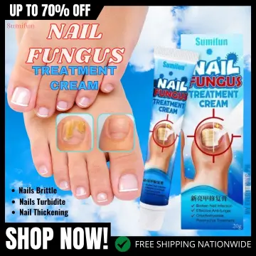 Discover 143+ nail fungus control extra strength latest - ceg.edu.vn