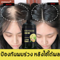 ZHENXIU สำหรับผมบาง แชมพูแก้ผมร่วง แชมพูเร่งผมยาว 250ml แชมพูลดผมร่วง สำหรับผมเสีย แตกปลาย หนังศีรษะมัน แชมพูสมุนไพร shampoo