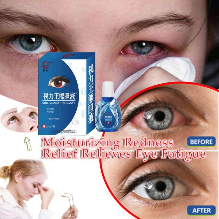 Original Blueberries Eye Drops for Clear Vision Dry Eyes Congestion eye ...