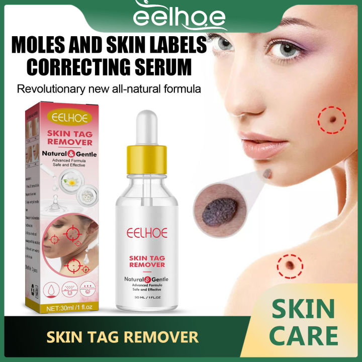 Eelhoe Skin Tag Remover Serum Repair Skin Neck Meat Particles Flat ...