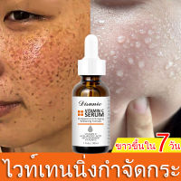 เซรั่มวิตซี vit c เซรั่มฝ้ากระ ไฮยาเซรั่ม เซรั่มบำรงหน้า ไวท์เทนนิ่ง กำจัดฝ้ากระ จุดด่างดำต่างๆ ให้ผิวเรียบเนียน ยกระดับผิวขาวใสfreckle serum