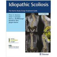 Scoliosis Idiopathic: คู่มือการทำทรีตเมนต์ของกลุ่มศึกษาที่เป็นอันตราย